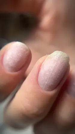 nails viral 