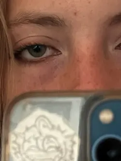 Sadness in eyes