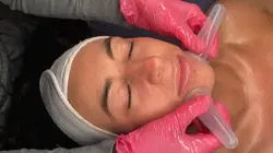 facial vid
