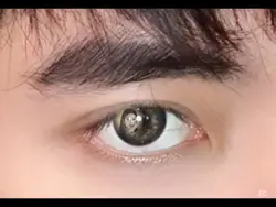 eyes