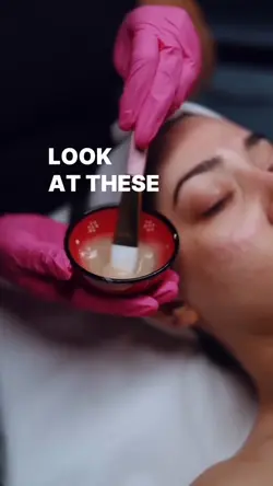 facial