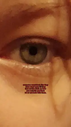 dead eyes