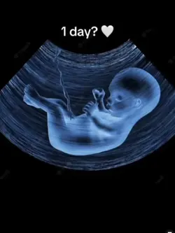Day 1