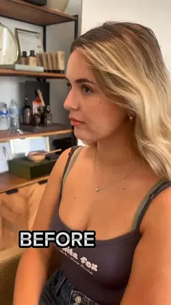 Before After