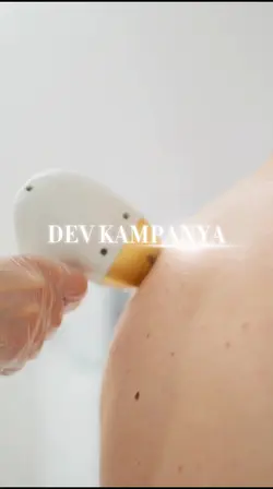 Lazer epilasyon