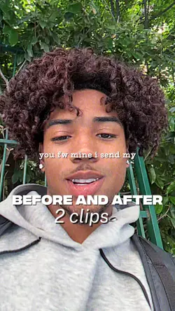 Before and After
