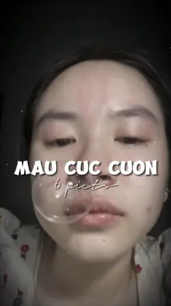 6 ẢNH GIẬT GIẬT CHÁY