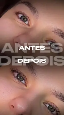 Antes e depois