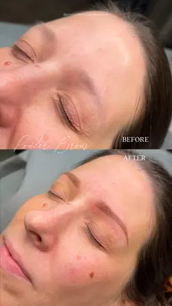Before after brows