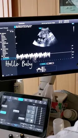 Hello baby