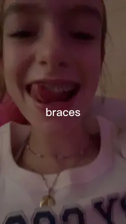 braces transition