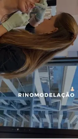 RINOMODELAÇÃO