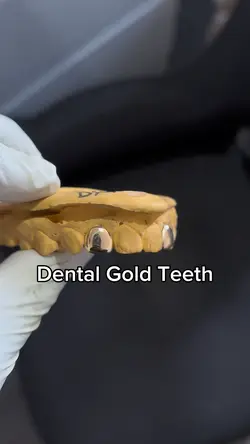 Dental GoldGrillz 