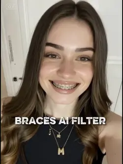 braces ai filter 