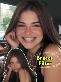 Braces filtee