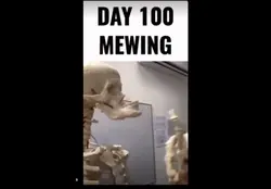 Day 100 Mewing
