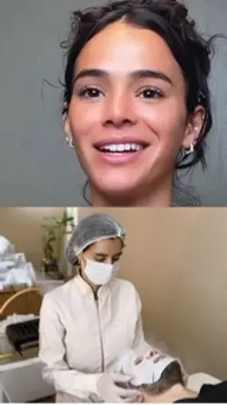 Meme limpeza de pele