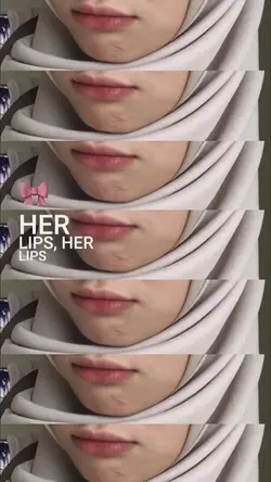 trend bibir estetik