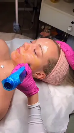 Microneedling aesthe