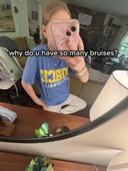 I’m clumsy ok?😭😭