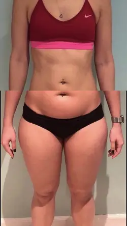 Antes e depois