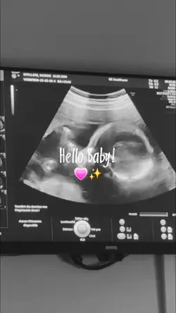 hello Baby