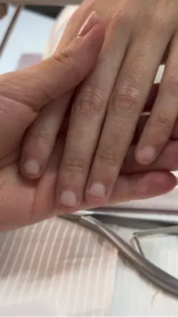 Before&After nails
