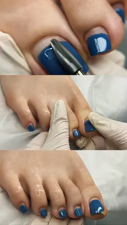 pedicure