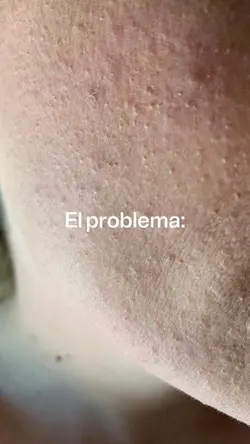 Problema vs solucion