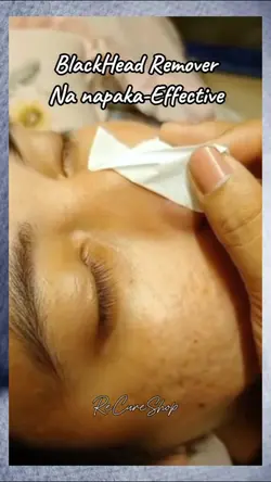 Blackhead Remover 