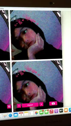estetik lowquality