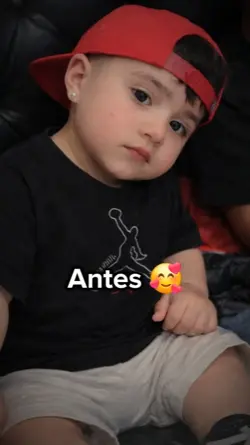 Antes y después