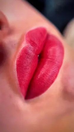 Lip filler 