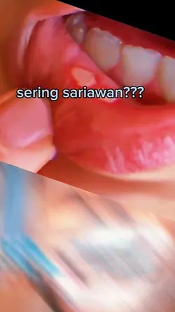 iklan odol
