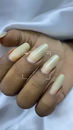 Antes e depois unhas