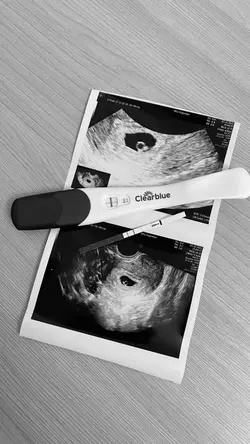 Pregnant Journey