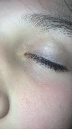 Eyes .