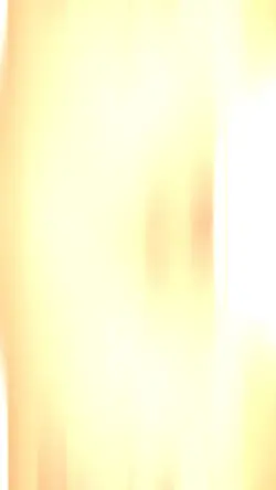 Laser tattoo removal