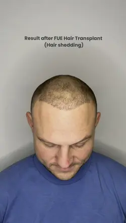 Add 8 clips