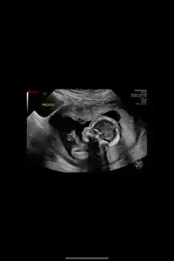 Maternity