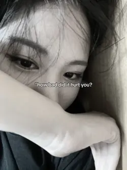 it hurt