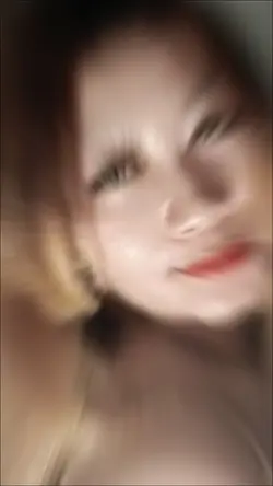 Luka yangku Rasakan