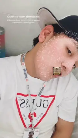 Ig:issac.notbae