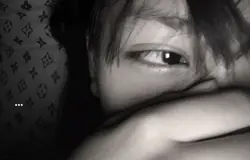 eye 
