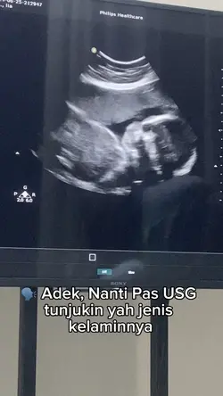 Usg Jenis kelamin