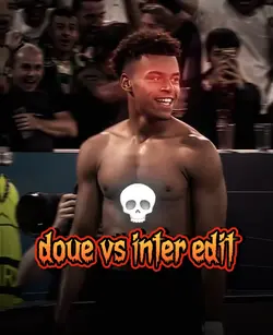 Doue vs inter edit
