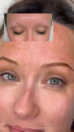 Before after brows