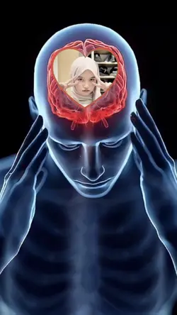 ISI KEPALA