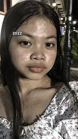 2022 và 2025