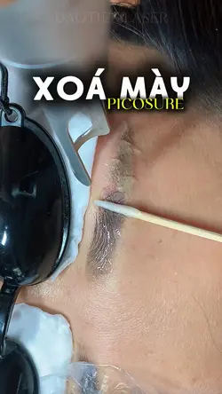 Laser